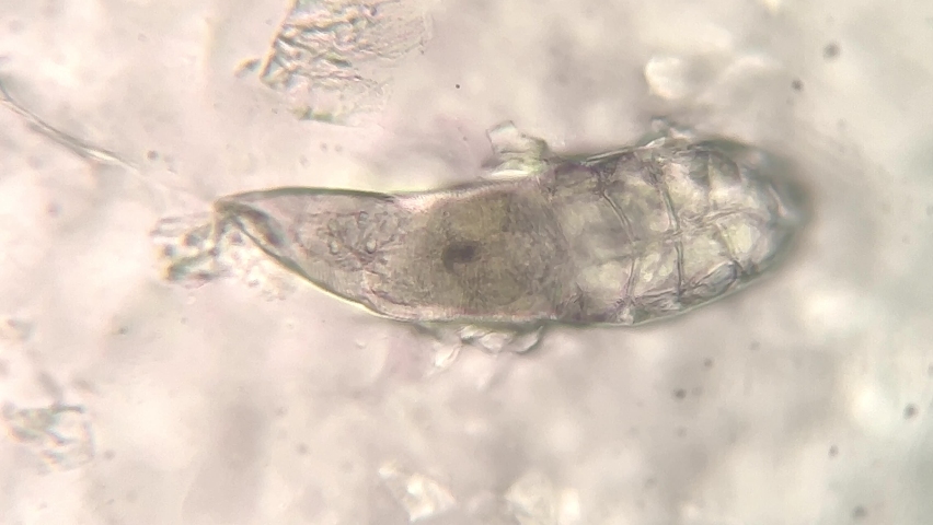 microscopic footage of Demodex or face mites Royalty-Free Stock Footage #1082280580