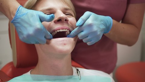 Orthodontist and teenage client at appointment. spbd Dentist installs aligners on teen boy upper jaw at medical procedure in professional clinic office