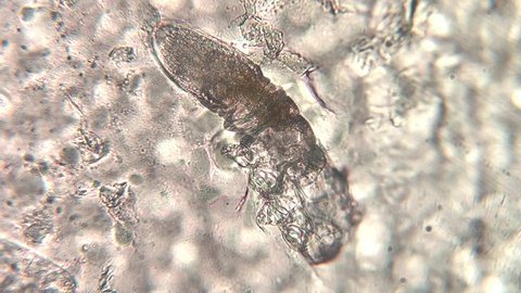 microscopic footage of Demodex or face mites