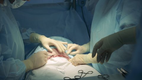 Surgeons are cutting patient's stomach