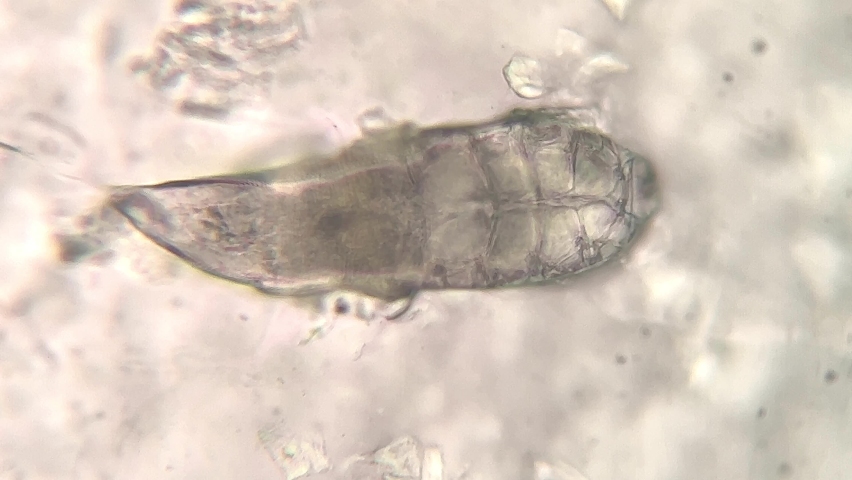 microscopic footage of Demodex or face mites Royalty-Free Stock Footage #1082619082