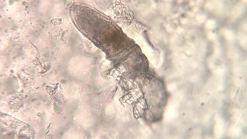 microscopic footage of Demodex or face mites Royalty-Free Stock Footage #1082619085