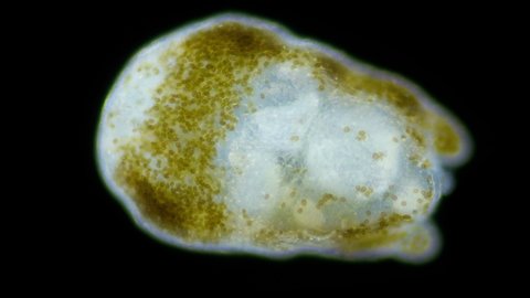 Worm Turbellaria, order Acoela under a microscope. In symbiosis with Zooxanthellae algae, which give him energy. Indian Ocean
