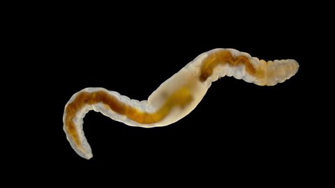 Oligochaeta worm under the microscope, class Clitellata, Phylum Annelida. Sample found in the Barents Sea