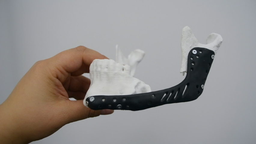 Person holding in hand facial mandibular endoprosthese printed metal 3D printer Royalty-Free Stock Footage #1082748205