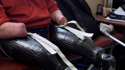 A man living with a disability with amputated arms and legs tries to put on a modern artificial bionic leg prosthesis and fix it with amputated two stump hands