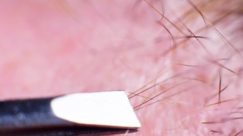 16 Man Pubic Hair Stock Video Footage - 4K and HD Video Clips | Shutterstock 16 Man Pubic Hair Stock Video Footage - 4K and HD Video Clips | Shutterstock