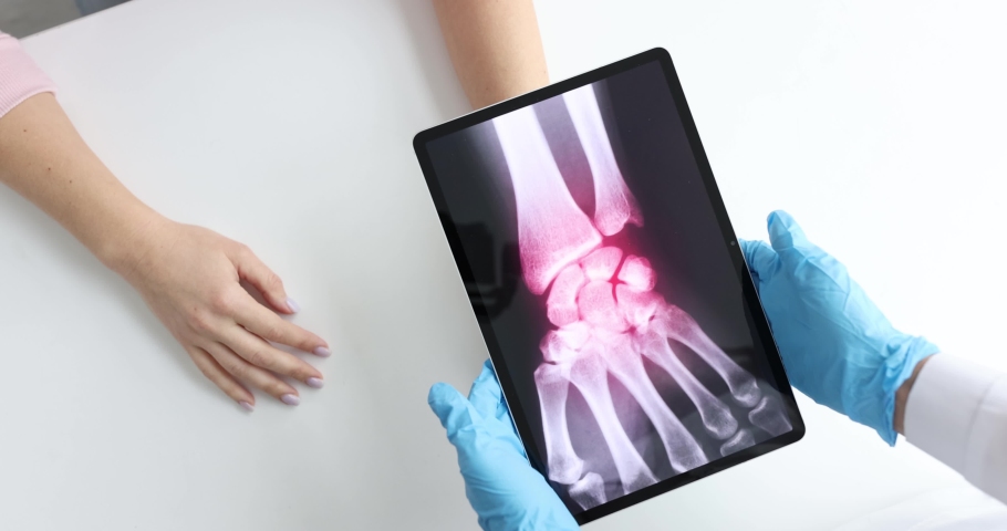 Doctor holds tablet with x-ray of patient hand slow motion 4k movie Royalty-Free Stock Footage #1083246970