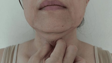 the hand squeezing sagging skin under the neck, fat layer under the chin.