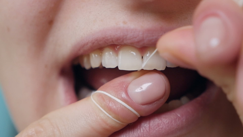 Close-up shot of a woman flossing her teeth while removing leftover food from the interdental space | Shutterstock HD Video #1083353770