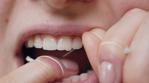 Close-up shot of a woman flossing her teeth while removing leftover food from the interdental space