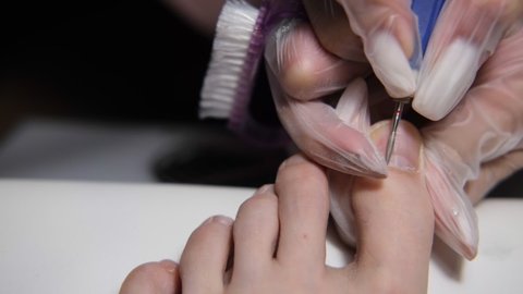 Podiatry. Removing calluses with a scalpel at the beautician.Podiatrist treating feet during procedure.Professional hardware pedicure using electric machine. High quality 4k footage