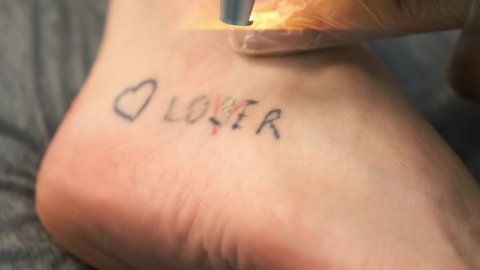 Laser removing of tattoo with words loser, lover and heart on woman's foot in red and black colours, closeup hands of doctor in gloves. Romantic tattoo symbol of youth love and disappointment in life.