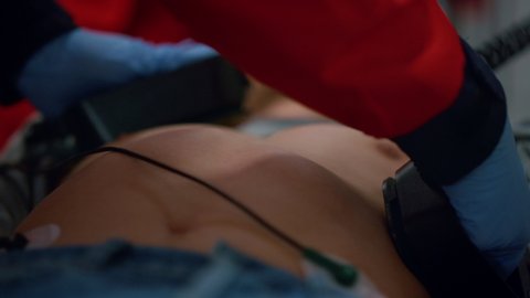 Closeup emergency doctor hands using external defibrillator on man chest. Unrecognizable paramedic in gloves rescuing patient. Medical assistant providing resuscitation to victim in ambulance car