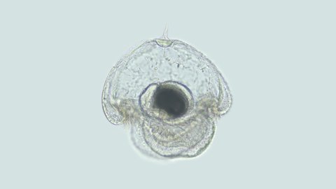 Larva of the worm Heteronemertea at pilidium stage under a microscope. Pilidiophora class. With help of cilia, it floats in the water column. Red sea