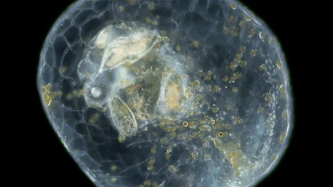 Worm Turbellaria, order Acoela under a microscope. One can see the statocyst: organ of balance and the perchyma, where food is digested. Indian ocean