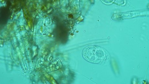 The single-celled organism actively explores its habitat in search of food. An entertaining living environment under a microscope. Microcosm in a drop of water