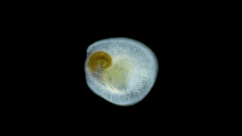 Acoela worm Convolutriloba under a microscope, Turbellaria, type Xenacoelomorpha. Genus Are found worldwide in marine and brackish waters. Red sea.