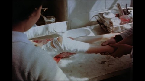 1940s: Nurse unwrapping gauze from leg.