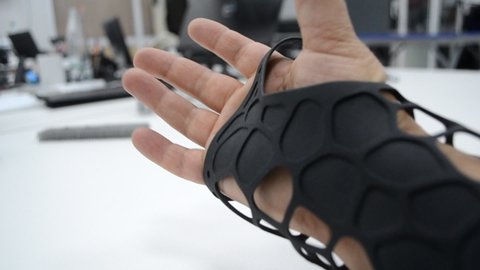 Black orthopedic plastic prosthesis printed on powder 3D printer on hand. Orthopedic gypsum is on arm close-up. Multi Jet Fusion MJF 3D printing technology. New modern progressive additive technology.
