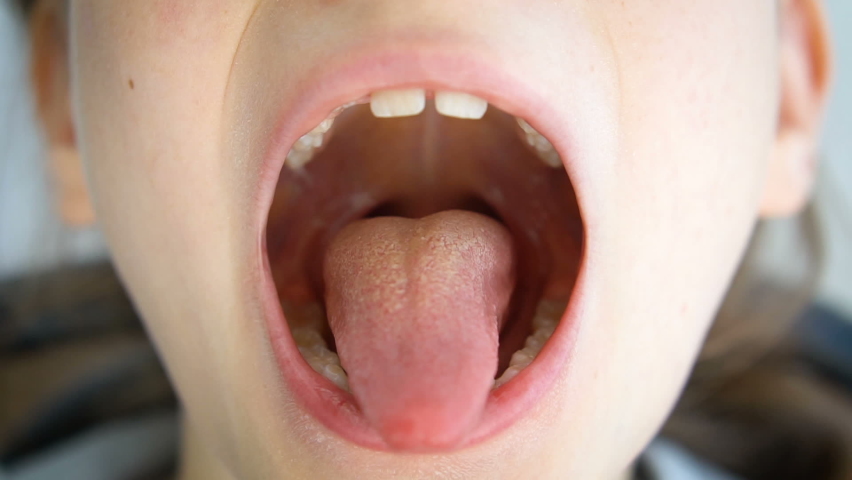 Giantess Uvula