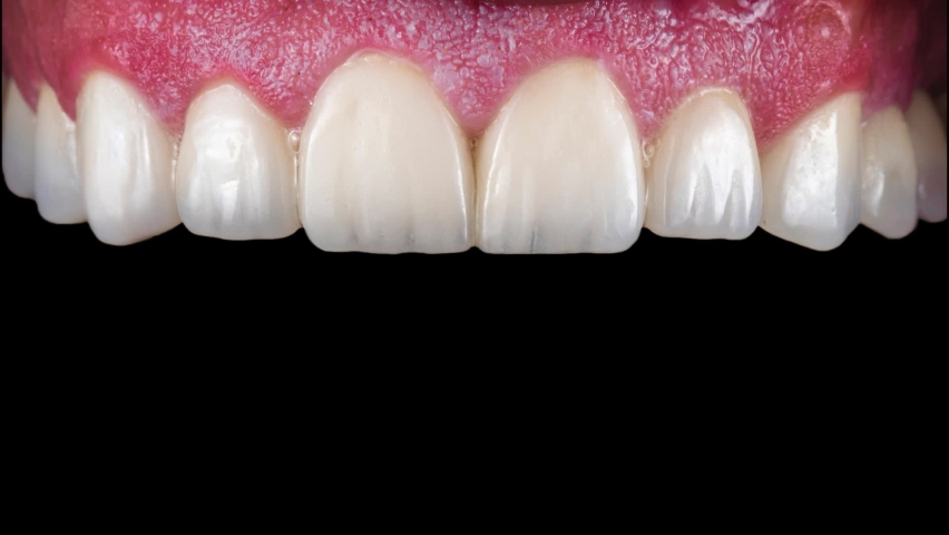 a new beautyful smile design