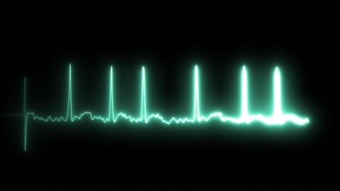 ECG in patients with atrial fibrillation. Animation of seamless loop.
