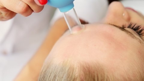Beautician cosmetologist makes face vacuum massage with cupping cup, professional cosmetic procedure in a beauty clinic salon for client. Smoothing deep forehead wrinkles. Cosmetology spa concept.
