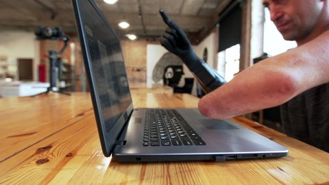 VLADIVOSTOK, RUSSIA - OCTOBER 18, 2021: A caucasian man with amputated two stump hands works online at the laptop is typing on the laptop using a modern bionic hand.