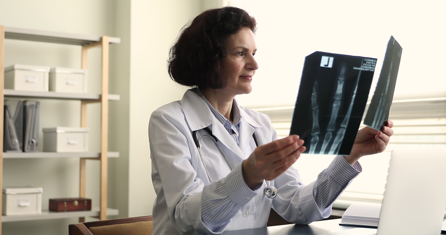 60s female doctor radiologist holding x-rays, examining injured bones, check before and after successful treatment scan results, looks satisfied. Healthcare, radiology professional occupation concept Royalty-Free Stock Footage #1085053666