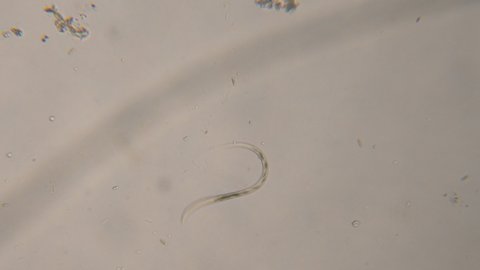 Nematode Worm Under Microscope, Parasites Among Roundworms: Roundworms, Pinworms, Trichinella. Bacteria Parasites and Worms in Drinking Water Under Microscope. Environmental Pollution.