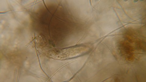 Nematode Worm Under Microscope, Parasites Among Roundworms: Roundworms, Pinworms, Trichinella. Bacteria Parasites and Worms in Drinking Water Under Microscope. Environmental Pollution.