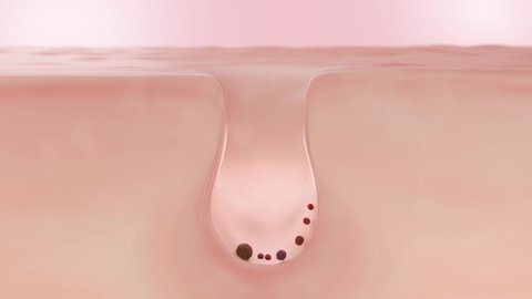 Clean dirty pore by water remove open pores, Face cleaning and Acne trouble concept. 3D rendering