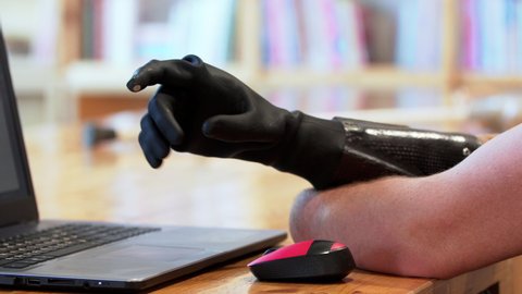 Close view of a new black modern bionic hand. A man living with a disability with amputated two stump hands is typing on the laptop using his robotic prosthesis
