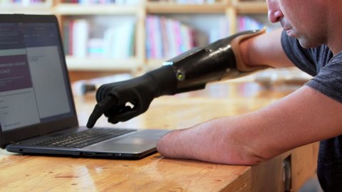 New black modern bionic hand. A man living with a disability with amputated two stump hands is typing on the laptop using his robotic prosthesis