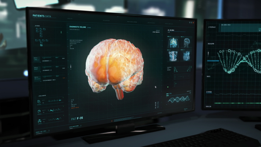Patients Brain Organ Examination Medical System Creates Medical Report For Doctor. Organ Examination Software Diagnostic Function Finds Brain Tumor. Advanced Organ Examination In Medical Laboratory | Shutterstock HD Video #1085182064