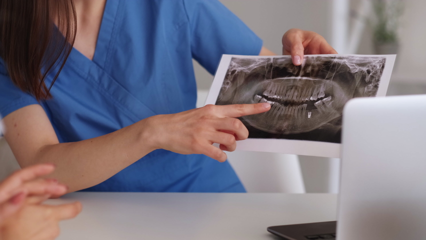 Dental implantation. Doctor consultation. Health care. Unrecognizable two women discussing teeth roentgenogram of patient in light room interior. | Shutterstock HD Video #1085200268