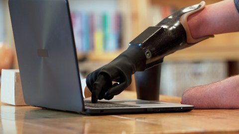 Close view of a black modern bionic hand. A caucasian man living with a disability with amputated two stump hands is typing on the laptop using his robotic prosthesis