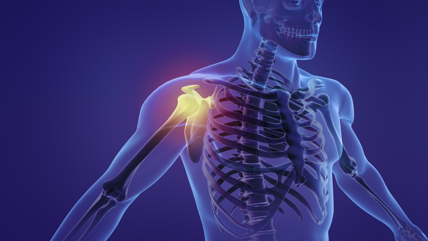 Animation of a painful shoulder Royalty-Free Stock Footage #1085276495