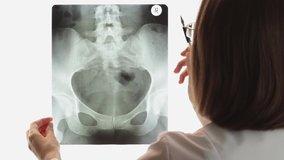 Female doctor with glasses holds and examines pelvic bones scan against background of light screen. Radiologist points to problem areas on X-ray. - Powered by Shutterstock - Get 15% off with code: PIKWIZARD15
