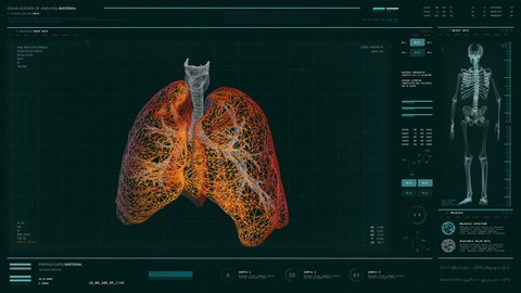 Medical Computer Scan Patients Therapy Analyzing Stock Footage Video ...