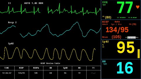 ECG System Ui Monitoring Health Condition Of Patient. Electrocardiogram System Monitoring And Recording Health Of Vital Organs. Monitoring System Testing Heart Health By Analyzing Electrical Signals