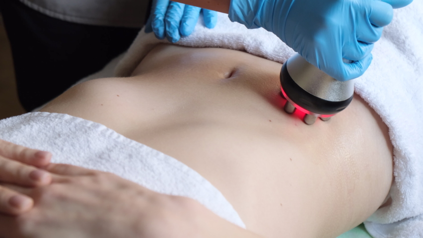 Cosmetology. A woman in a spa clinic receives an RF lifting procedure on a preparation for the abdomen and hips   | Shutterstock HD Video #1085993633