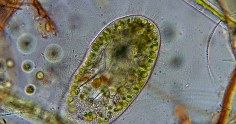 Protozoa protists unicellular organism under microscope Euglena, Paramecium and amoebas 800x magnification 