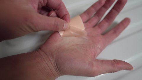This close up video shows anonymous hands removing a bandaid and revealing a wound.