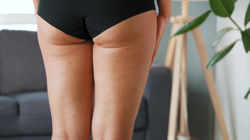 Woman compressing the skin on her buttocks and sides checking for cellulite and excess subcutaneous fat