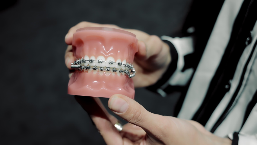 The dentist holds an artificial dental jaw with orthodontic braces on his teeth. Demonstration of orthodontists and braces on the model. | Shutterstock HD Video #1086314876