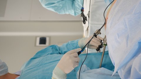 Laparoscopic instruments in action during abdomen surgery. Closeup shot. Vertical footage. Laparoscopic intervention in hospital operating room. Laparoscopy in modern medicine. 4 k video