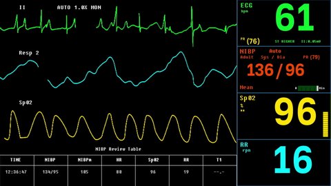 Electronic Health Monitor Machine Checks Vital Signs Of Ill Patient. Electronic Machine Detects Decline In Vital Signs Of Patients Heart. Electronic Machine Monitors Vital Signs Of Patient. ECG