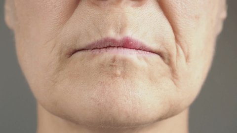Close-up of female lips affected by herpes. Woman spreading a healing cream on a sore spot